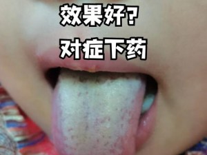 姬小满红脸张嘴是怎么回事？如何解决？