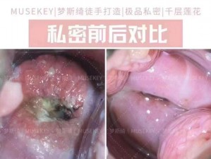 经常自己安慰会得 HPV 吗？女生应该了解的私密问题