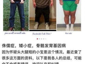 为什么侏儒 xxxhd 会出现这种情况？应该如何解决？