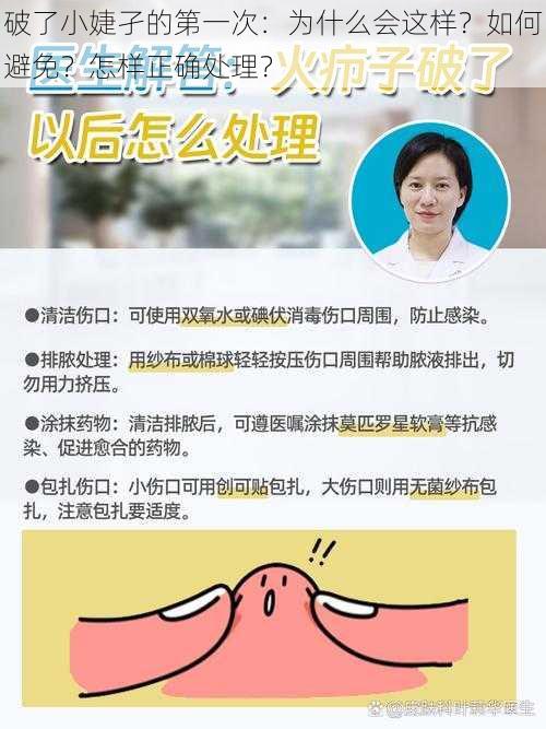 破了小婕孑的第一次：为什么会这样？如何避免？怎样正确处理？