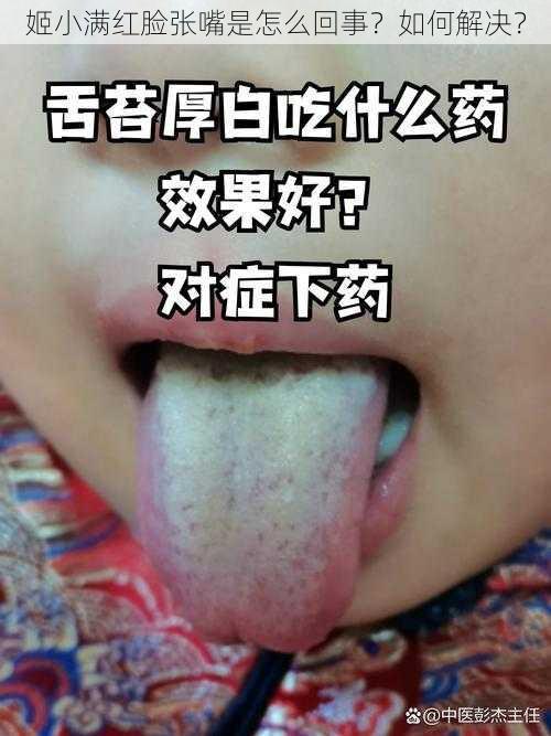 姬小满红脸张嘴是怎么回事？如何解决？