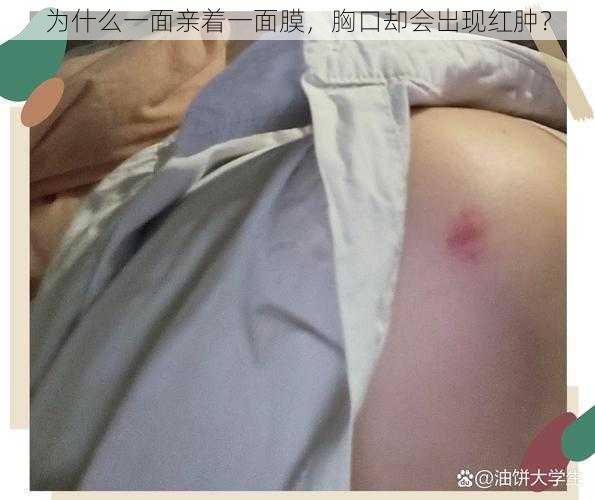 为什么一面亲着一面膜，胸口却会出现红肿？